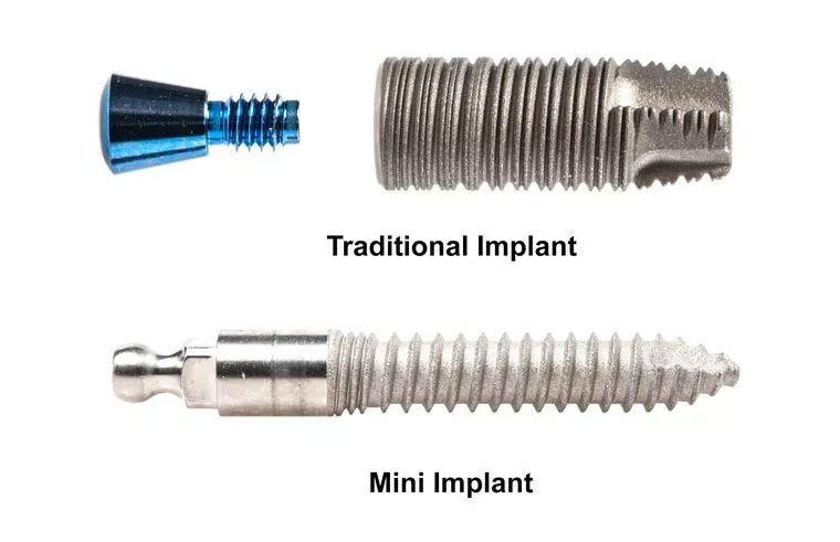 Implants 2